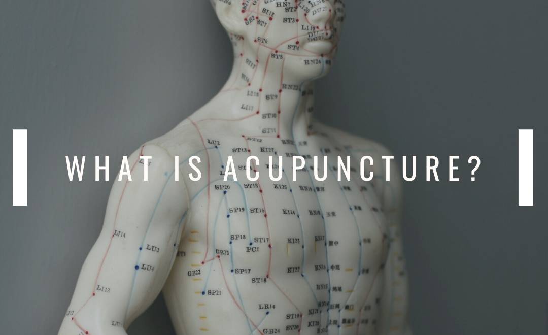 What isAcupuncture ?